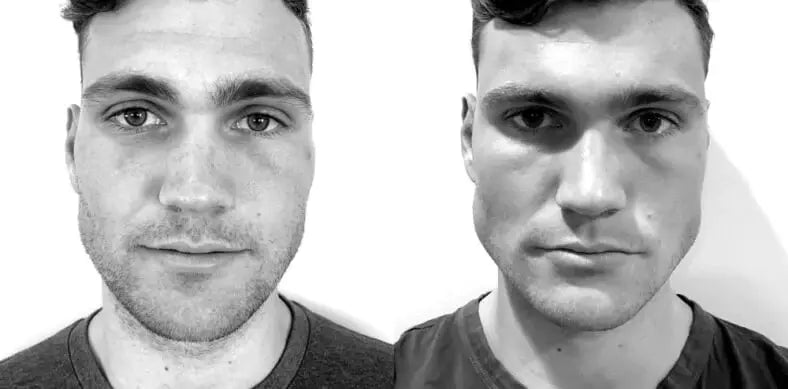 Face Fat or Water Retention? How to Tell the Difference
