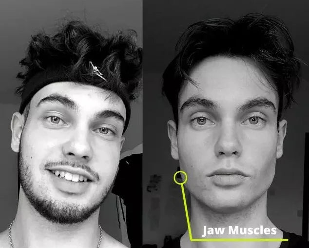 Does Chewing Gum Help Get A Defined Jawline