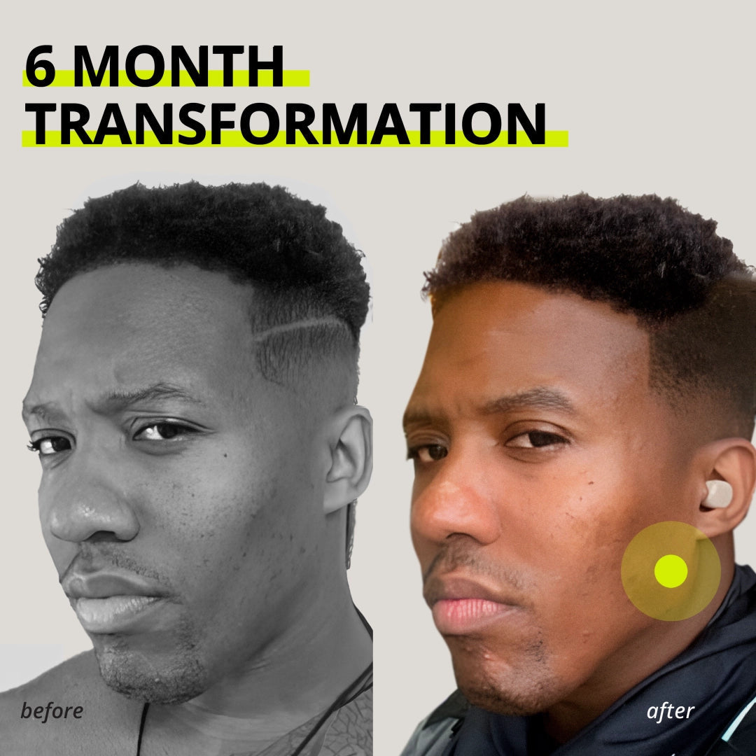 JAWLINER® Essential Pack