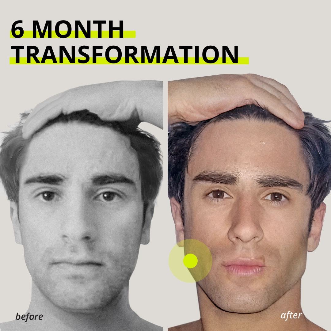 JAWLINER® 3.0 - Beginner