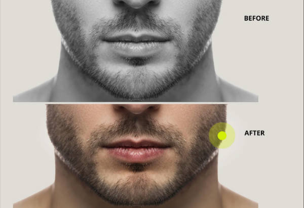 Mewing: Revolutionary way to get the most out of your facial exercises