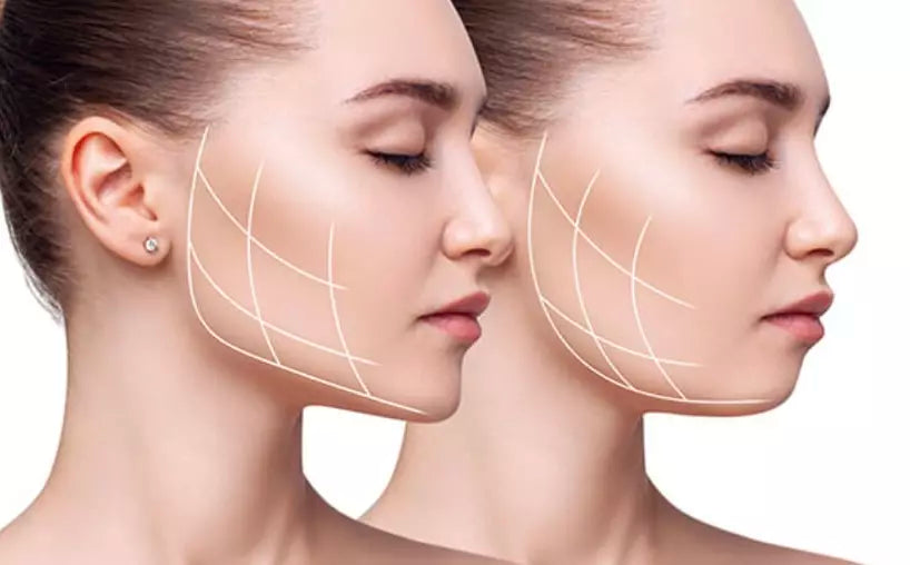 Hilft Kaugummikauen deiner Kieferlinie