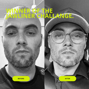 JAWLINER® Chewing Gum Hard