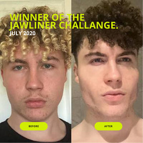 JAWLINER® Gum Ultra Hard