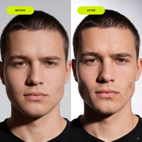 JAWLINER® DeBloat